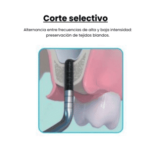 Piezotome® Cube – Cirugía Ósea con Precisión y Confort - Imagen 3
