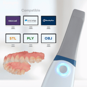 Runyes Escáner Intraoral 3DS V3 — Escaneo rápido y preciso en consultas odontológicas - Imagen 4