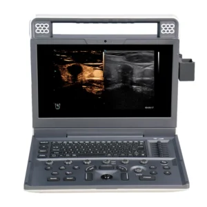 Equipo de Ultrasonido tipo Laptop (C2) - Imagen 5